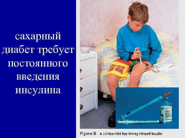 сахарный диабет требует постоянного введения инсулина 