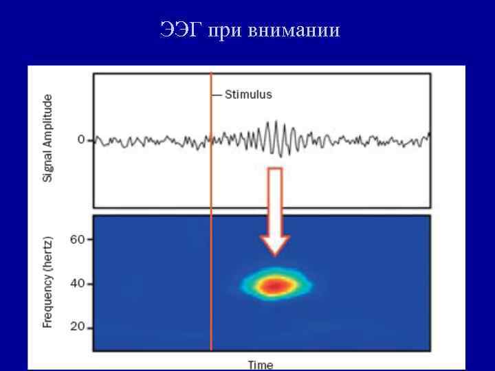 ЭЭГ при внимании 