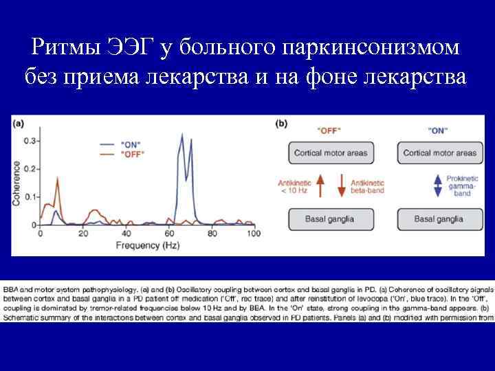 Срок действия электроэнцефалограмма для водителя