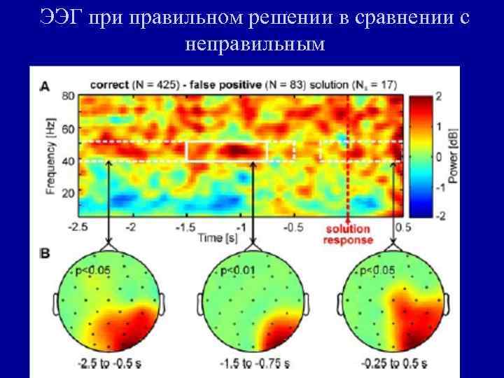 ЭЭГ при правильном решении в сравнении с неправильным 