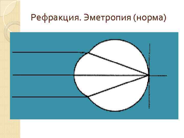 Рефракция. Эметропия (норма) 