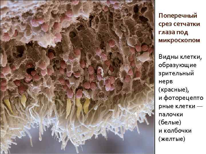 Поперечный срез сетчатки глаза под микроскопом Видны клетки, образующие зрительный нерв (красные), и фоторецепто