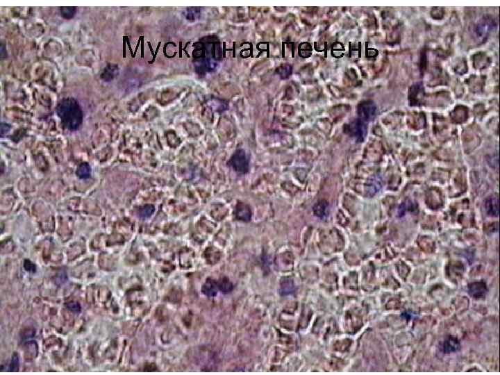Мускатная печень 