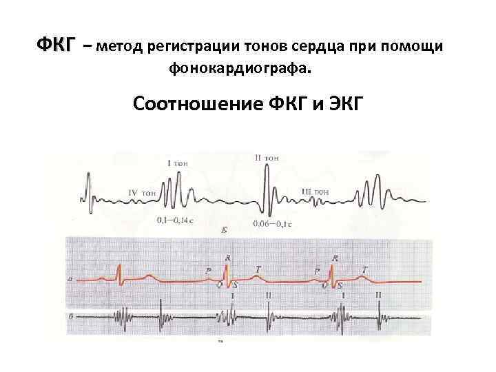 ФКГ – метод регистрации тонов сердца при помощи фонокардиографа. Соотношение ФКГ и ЭКГ 
