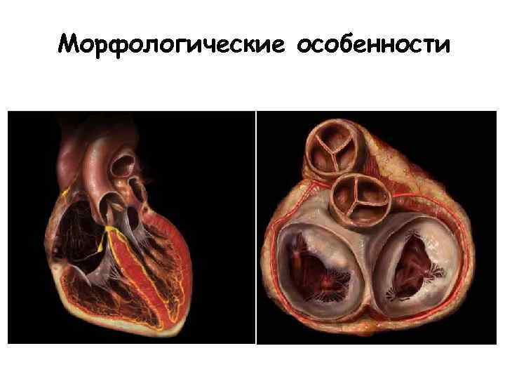 Морфологические особенности 