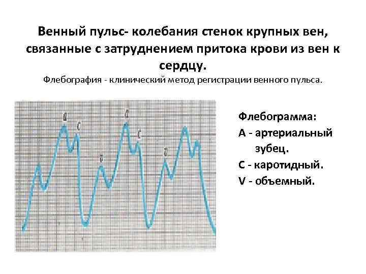 Венный пульс- колебания стенок крупных вен, связанные с затруднением притока крови из вен к