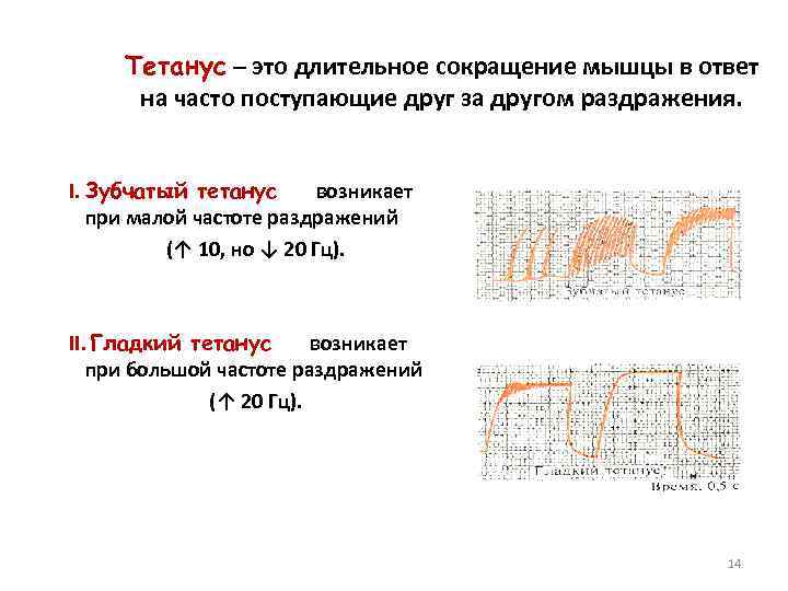 Тетанус – это длительное сокращение мышцы в ответ на часто поступающие друг за другом