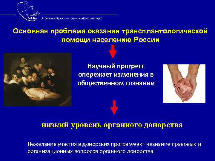 Основная проблема оказания трансплантологической помощи населению России Научный прогресс опережает изменения в общественном сознании