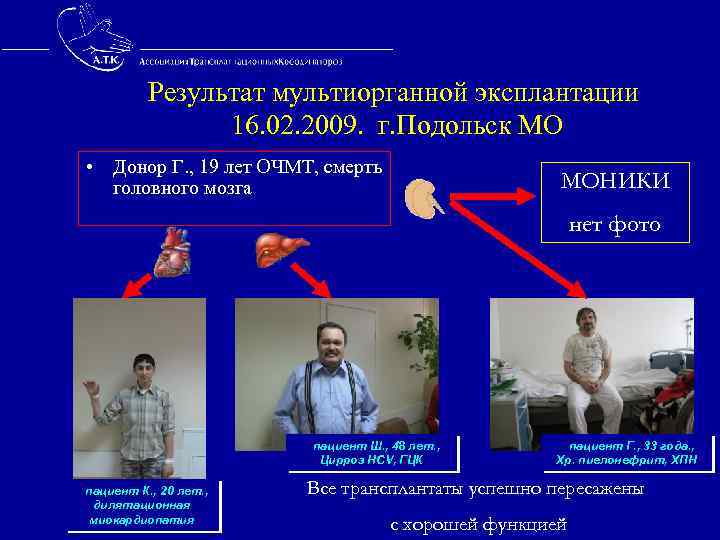  Результат мультиорганной эксплантации 16. 02. 2009. г. Подольск МО • Донор Г. ,