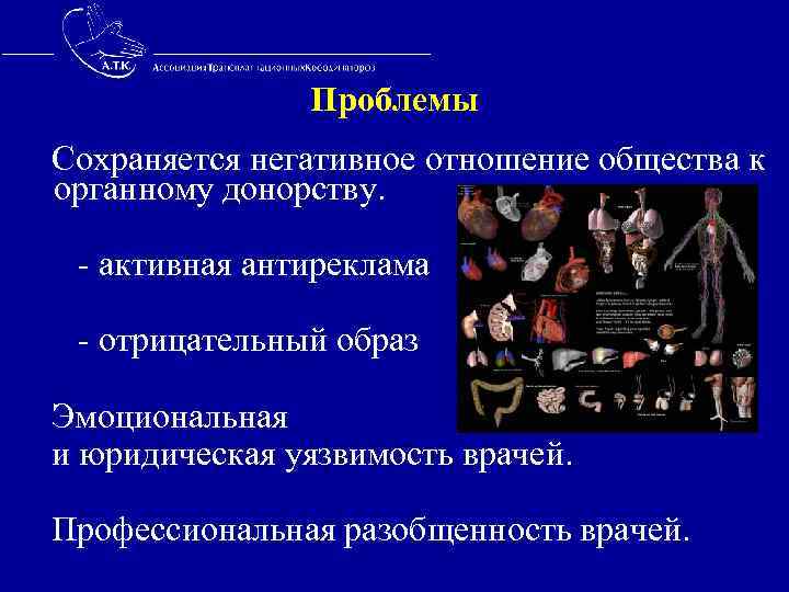  Проблемы Сохраняется негативное отношение общества к органному донорству. - активная антиреклама - отрицательный