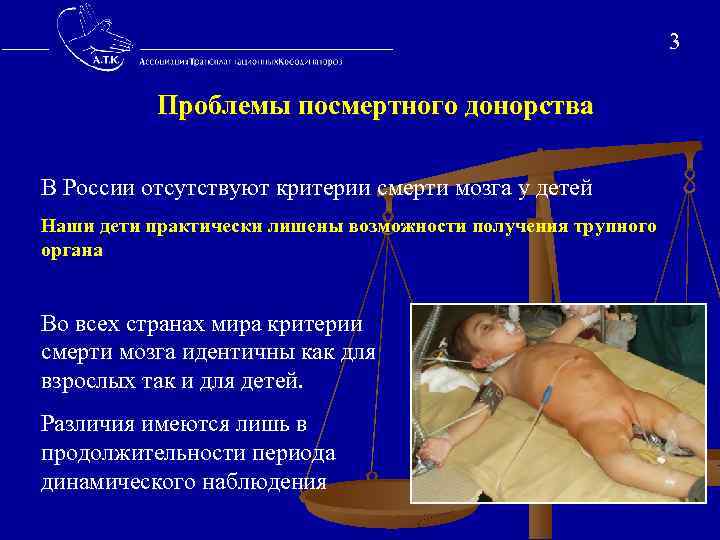  3 Проблемы посмертного донорства В России отсутствуют критерии смерти мозга у детей Наши