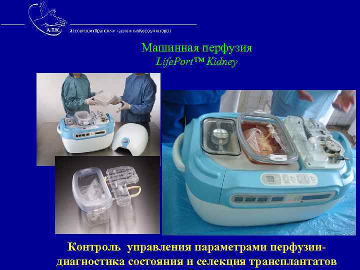  Машинная перфузия Life. Port™ Kidney Контроль управления параметрами перфузии- диагностика состояния и селекция