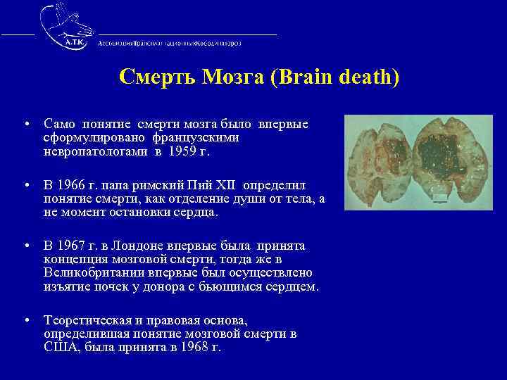  Смерть Мозга (Brain death) • Само понятие смерти мозга было впервые сформулировано французскими