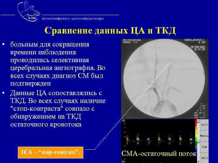  Сравнение данных ЦА и ТКД • больным для сокращения времени наблюдения проводилась селективная