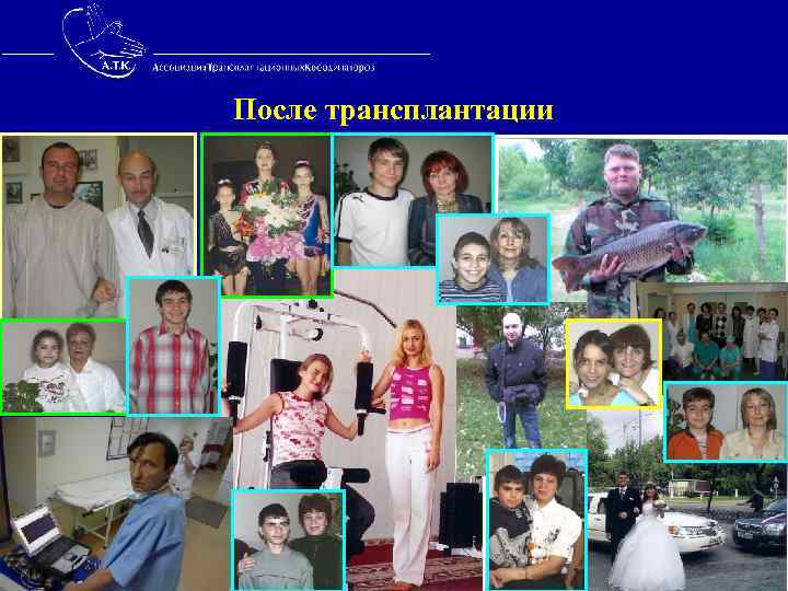 После трансплантации 