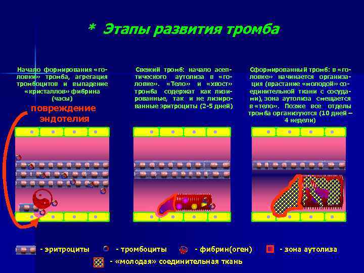 * Этапы развития тромба Начало формирования «головки» тромба, агрегация тромбоцитов и выпадение «кристаллов» фибрина