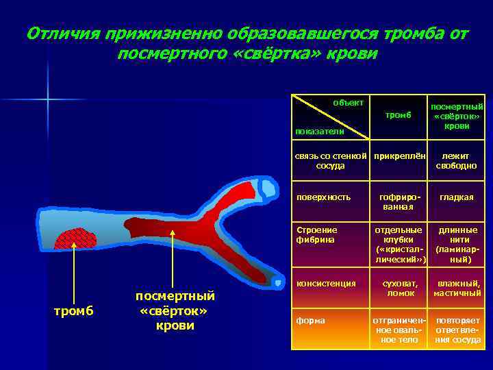 Отличия прижизненно образовавшегося тромба от посмертного «свёртка» крови объект тромб показатели связь со стенкой