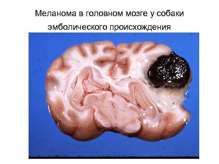 Меланома в головном мозге у собаки эмболического происхождения 