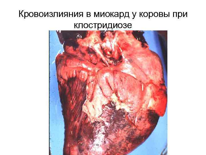 Кровоизлияния в миокард у коровы при клостридиозе 