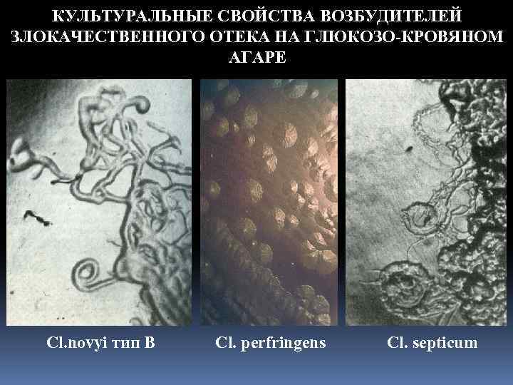 КУЛЬТУРАЛЬНЫЕ СВОЙСТВА ВОЗБУДИТЕЛЕЙ ЗЛОКАЧЕСТВЕННОГО ОТЕКА НА ГЛЮКОЗО-КРОВЯНОМ АГАРЕ Cl. novyi тип В Cl. perfringens