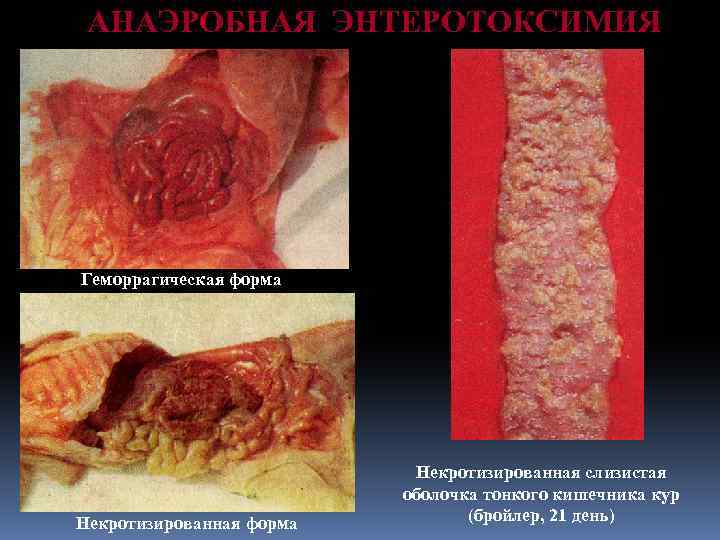 АНАЭРОБНАЯ ЭНТЕРОТОКСИМИЯ Геморрагическая форма Некротизированная слизистая оболочка тонкого кишечника кур (бройлер, 21 день) 