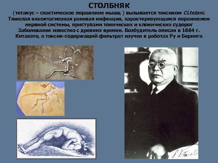 СТОЛБНЯК (тетанус – спастическое поражение мышц ) вызывается токсином Cl. tetani. Тяжелая неконтагиозная раневая