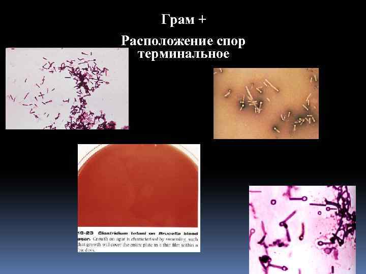 Грам + Расположение спор терминальное 
