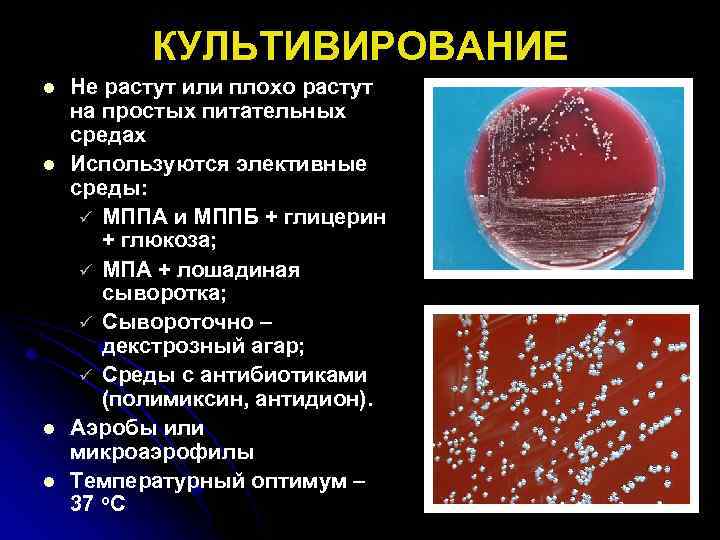 КУЛЬТИВИРОВАНИЕ l l Не растут или плохо растут на простых питательных средах Используются элективные