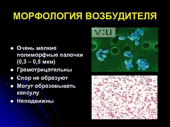 МОРФОЛОГИЯ ВОЗБУДИТЕЛЯ l l l Очень мелкие полиморфные палочки (0, 3 – 0, 5