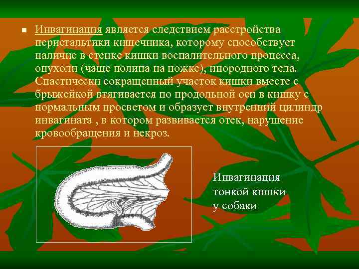 n Инвагинация является следствием расстройства перистальтики кишечника, которому способствует наличие в стенке кишки воспалительного