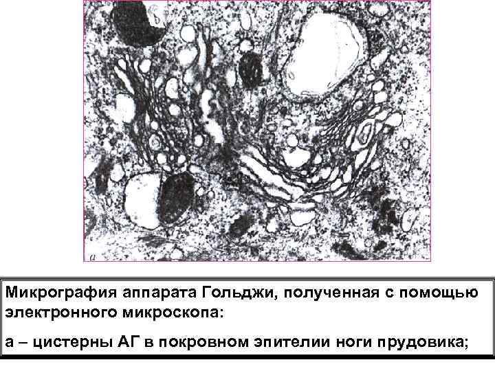 Микрография аппарата Гольджи, полученная с помощью электронного микроскопа: а – цистерны АГ в покровном