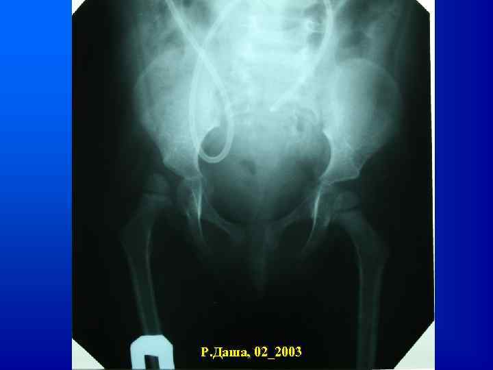 Р. Даша, 02_2003 