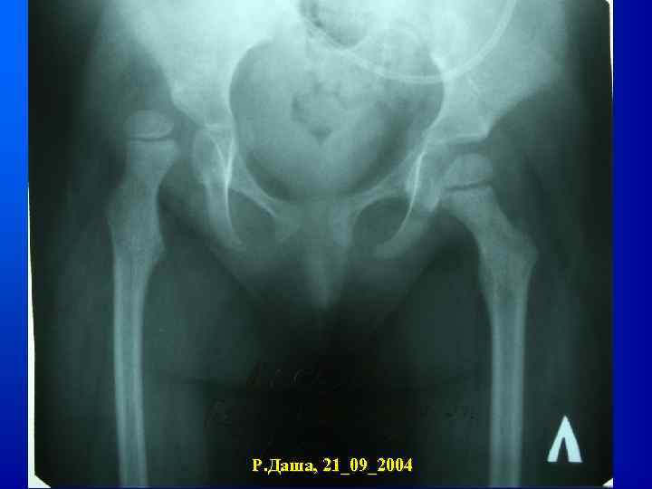 Р. Даша, 21_09_2004 