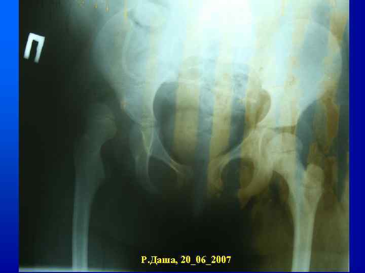 Р. Даша, 20_06_2007 