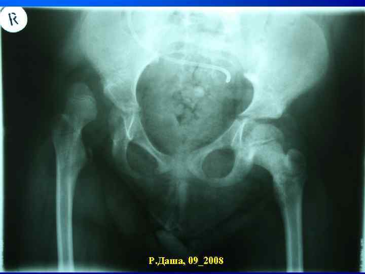 Р. Даша, 09_2008 