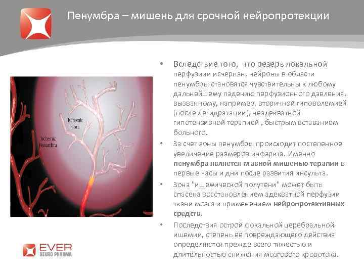 Пенумбра – мишень для срочной нейропротекции • • Вследствие того, что резерв локальной перфузиии