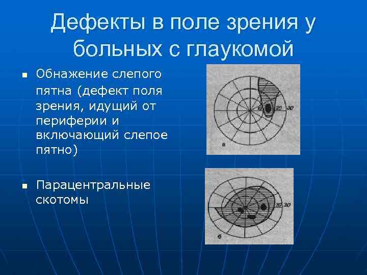 Поле дефекта