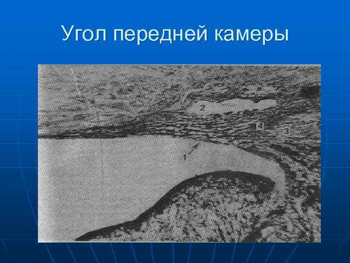 Угол передней камеры 