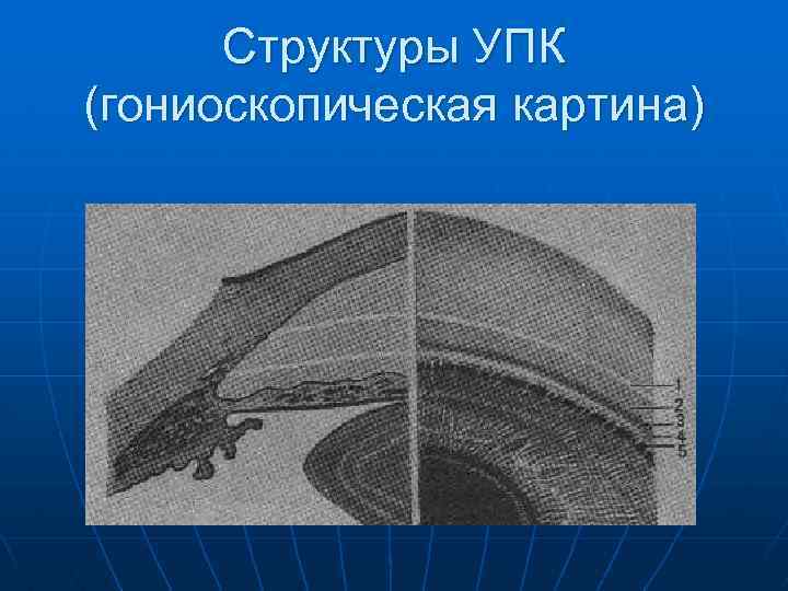 Структуры УПК (гониоскопическая картина) 