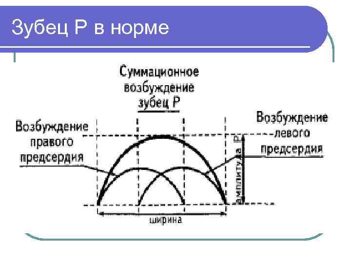 Зубец P в норме 