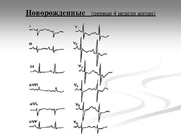 Новорожденные (первые 4 недели жизни) 