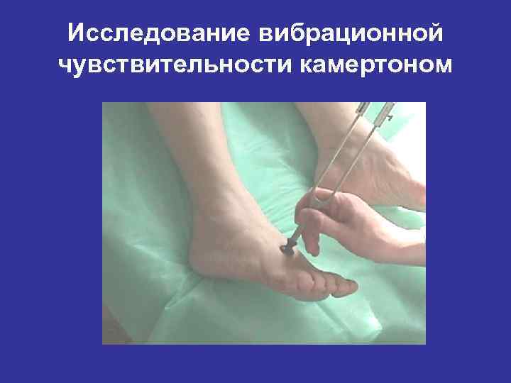 Исследование вибрационной чувствительности камертоном 