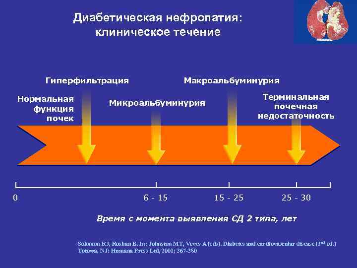 Диабетическая нефропатия: клиническое течение Макроальбуминурия Гиперфильтрация Нормальная функция почек 0 Терминальная почечная недостаточность Микроальбуминурия