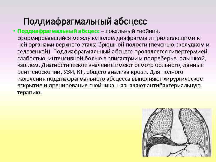  Причины поддиафрагмального абсцесса • Основная роль в возникновении поддиафрагмального абсцесса  принадлежит аэробной