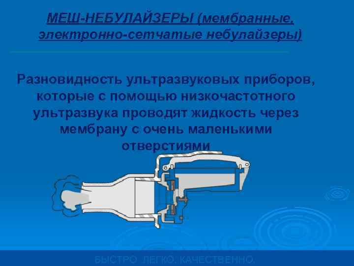 МЕШ-НЕБУЛАЙЗЕРЫ (мембранные, электронно-сетчатые небулайзеры) Разновидность ультразвуковых приборов, которые с помощью низкочастотного ультразвука проводят жидкость