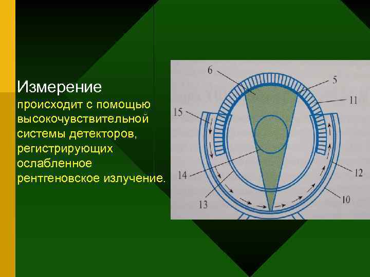 Измерение происходит с помощью высокочувствительной системы детекторов, регистрирующих ослабленное рентгеновское излучение. 