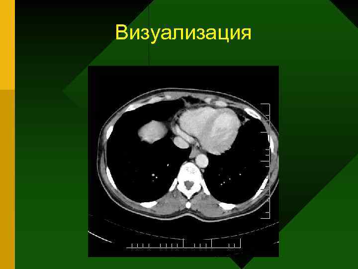 Визуализация 