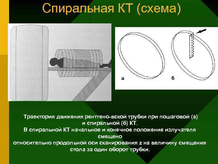 Спиральная КТ (схема) Траектория движения рентгено вской трубки при пошаговой (а) и спиральной (б)