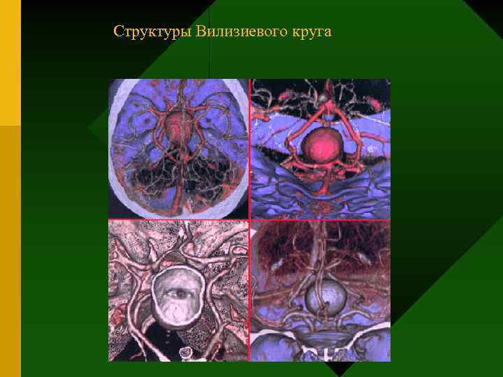 Структуры Вилизиевого круга 