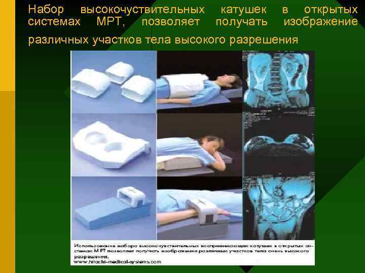 Набор высокочуствительных катушек системах МРТ, позволяет получать в открытых изображение различных участков тела высокого